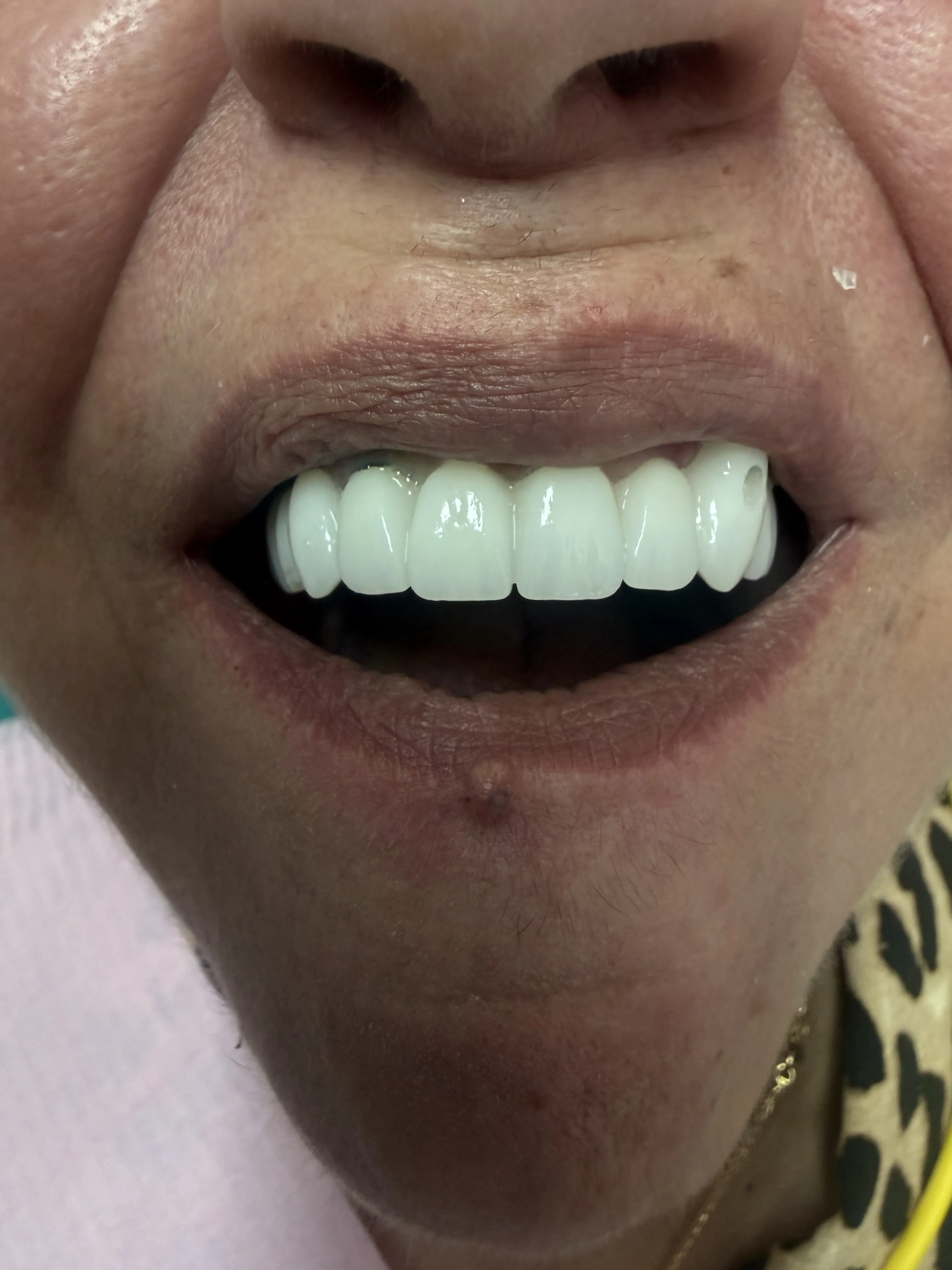 După Reabilitare Estetică